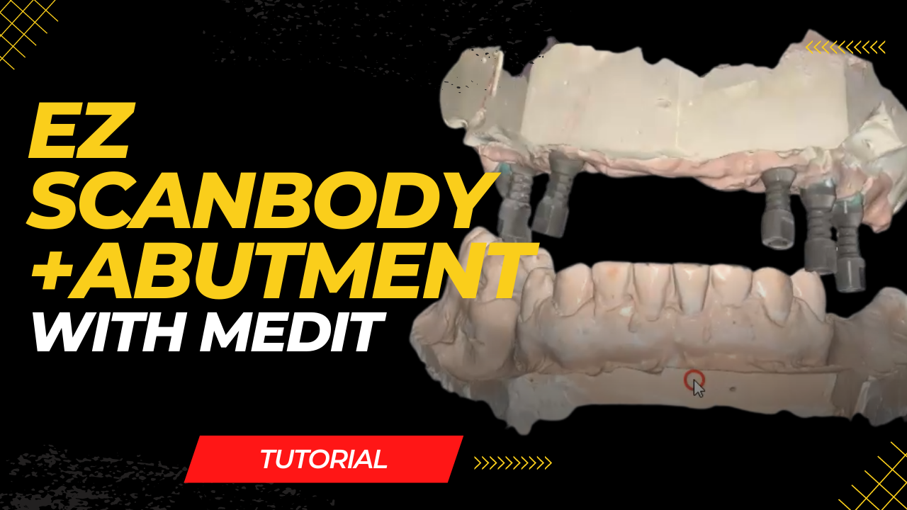 EZ Scanbody +Abutment Medit Setup