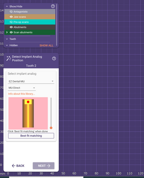 Exocad Library for EZ Scanbody+Abutment